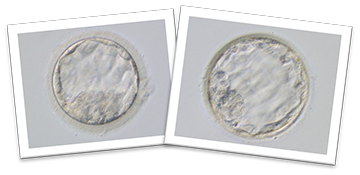 福井大学医学部附属病院／高度生殖医療センター